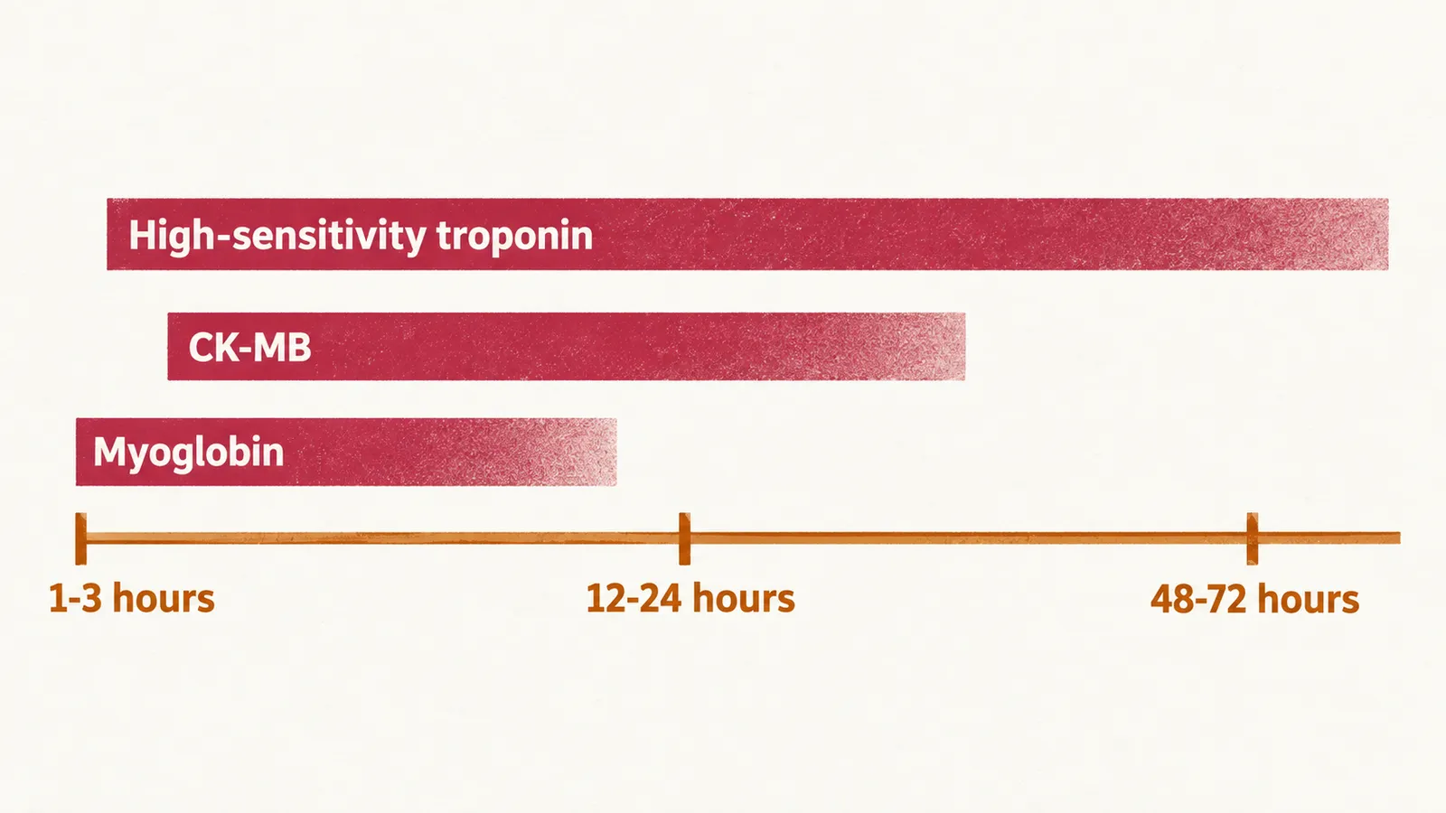 A timeline with ticks labelled 1-3 hours, 12-24 hours and 48-72 hours, and three crimson bars: myoglobin rising earliest, CK-MB in the middle, and high-sensitivity troponin extending furthest right.