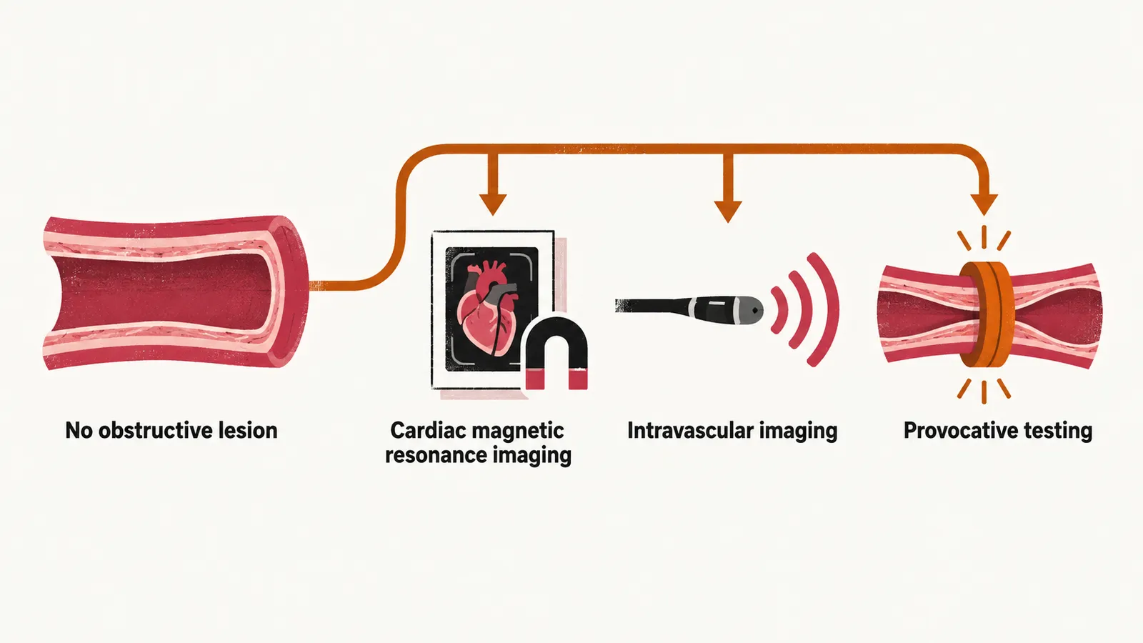 An open vessel icon labelled No obstructive lesion at the left, with a saffron line that branches to three tests, a pad with a magnet, a catheter tip with arcs and a pinched vessel.
