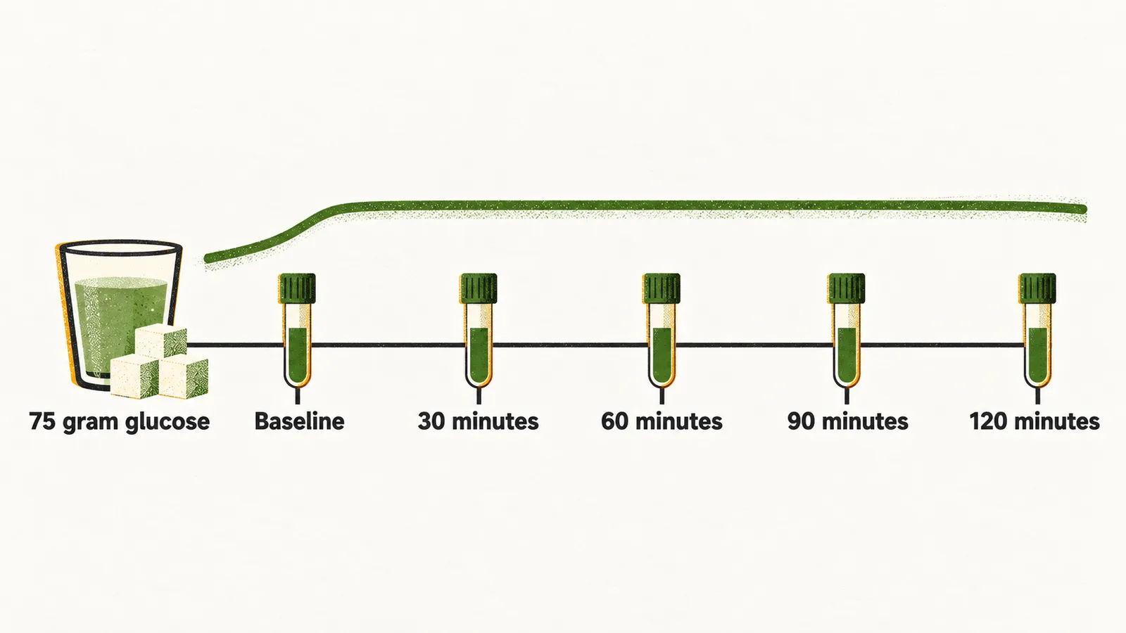 A timeline of the oral glucose tolerance test shows a 75 gram glucose load and blood sampling at baseline and 30, 60, 90 and 120 minutes.