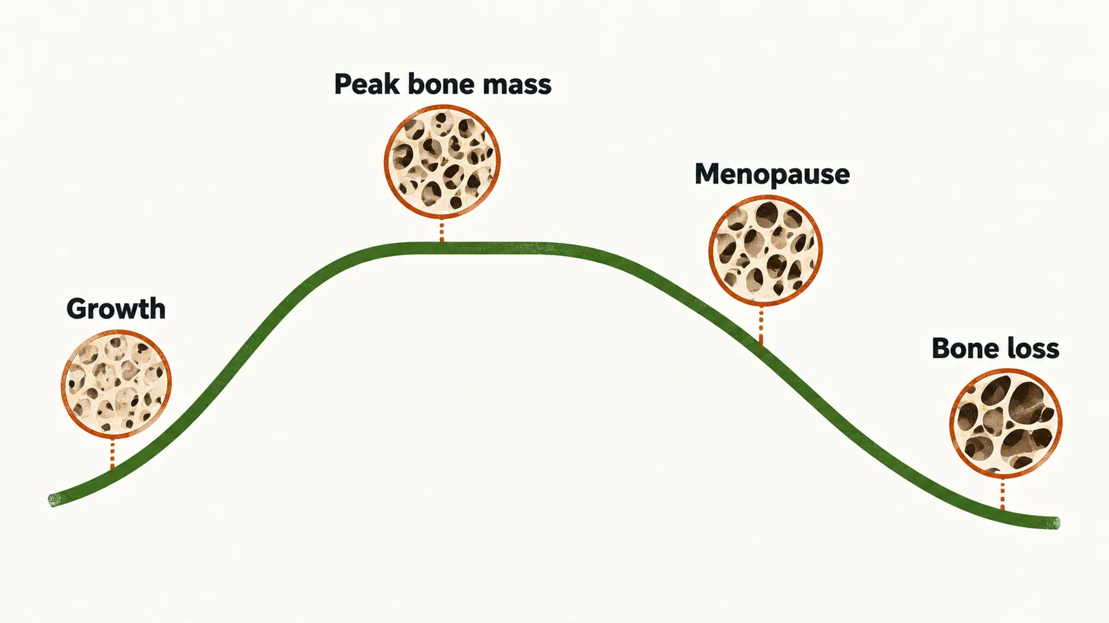 A rising then falling line labelled Growth, Peak bone mass, Menopause and Bone loss.