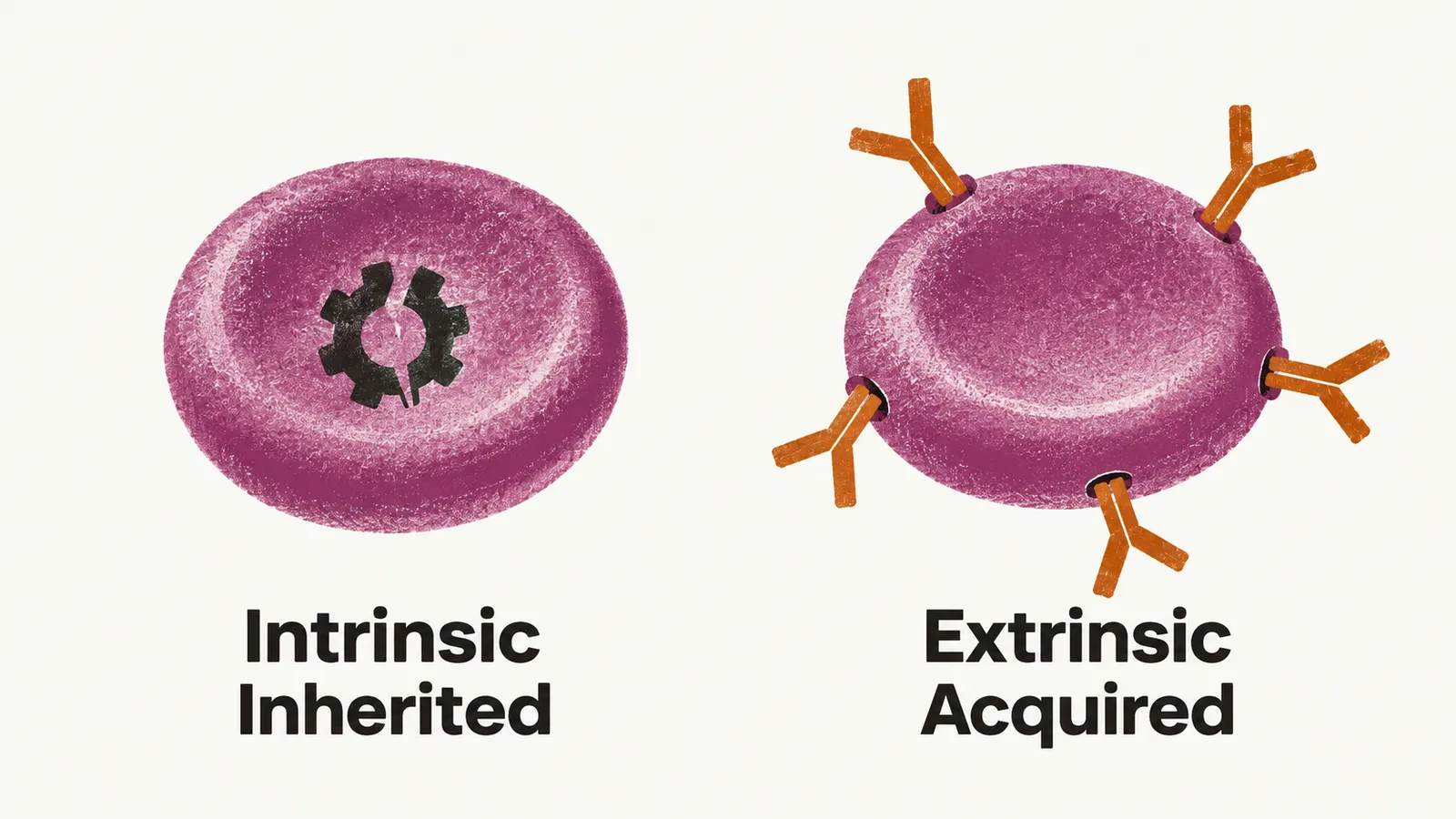 Two panels: a red-cell disc with a fault inside, labelled Intrinsic and Inherited, and a normal disc gripped by Y-shaped antibodies, labelled Extrinsic and Acquired.