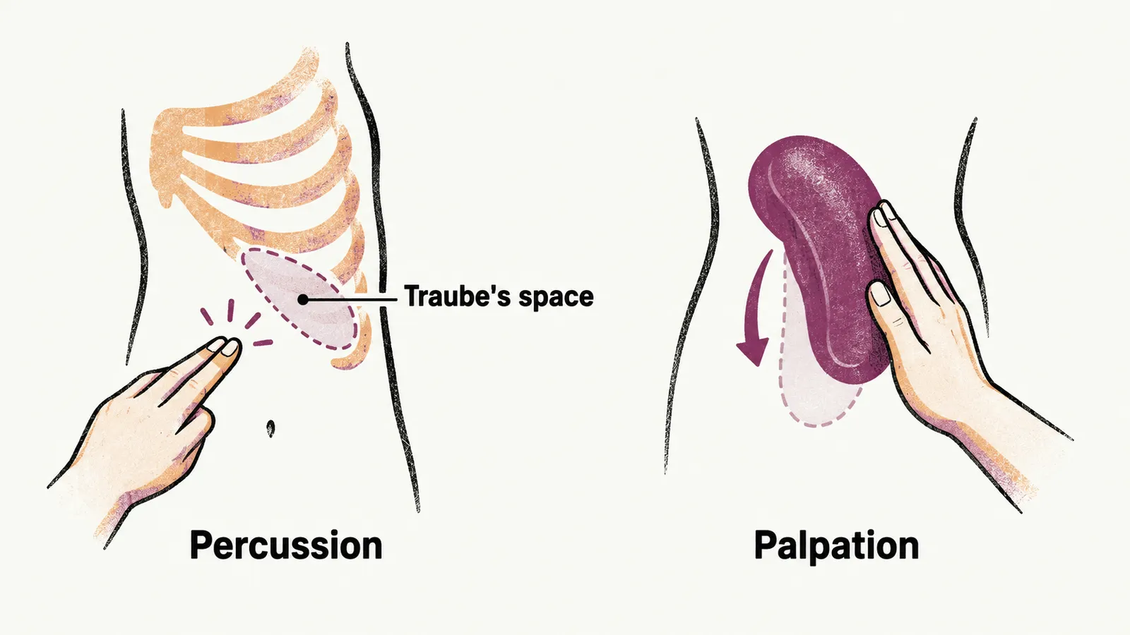 Two bedside tests are shown, tapping over Traube's space near the left ribs, and a hand feeling for the spleen as it descends on inspiration.