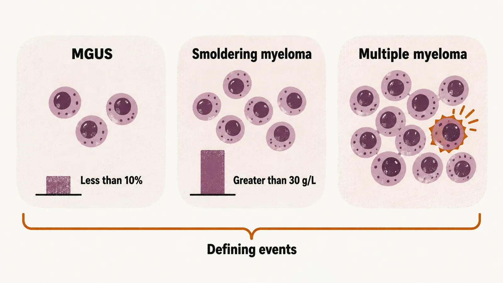 Three columns comparing MGUS, smoldering myeloma and multiple myeloma by plasma cell percentage, M protein level and defining events.