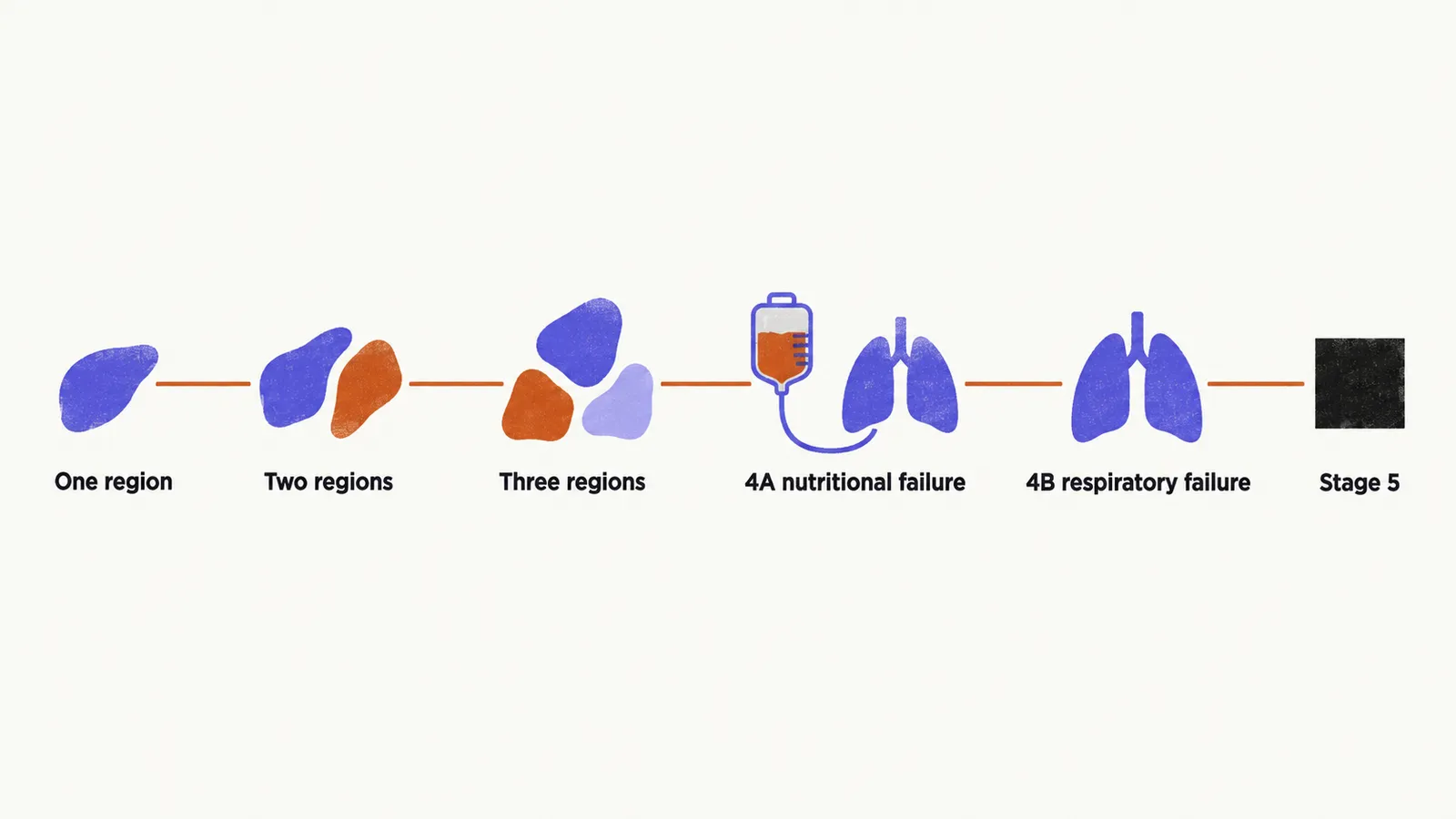 Five stations along a saffron line: one region, two regions, three regions, then 4A nutritional failure and 4B respiratory failure, ending at a solid dark square for Stage 5.
