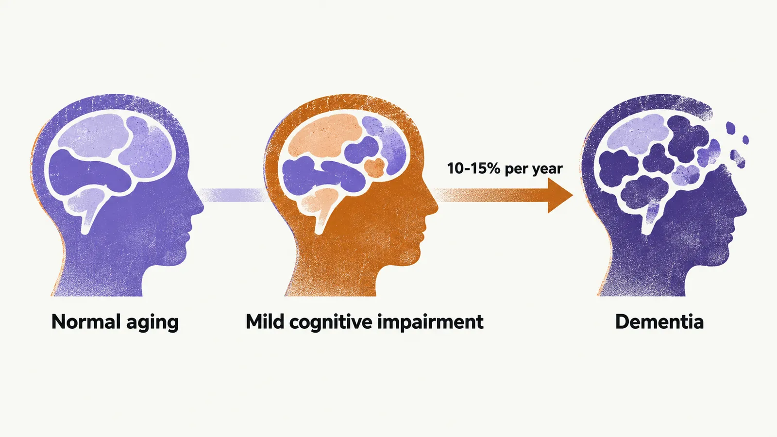 A left-to-right timeline marking normal aging, mild cognitive impairment, and dementia, with an arrow showing the yearly progression rate.