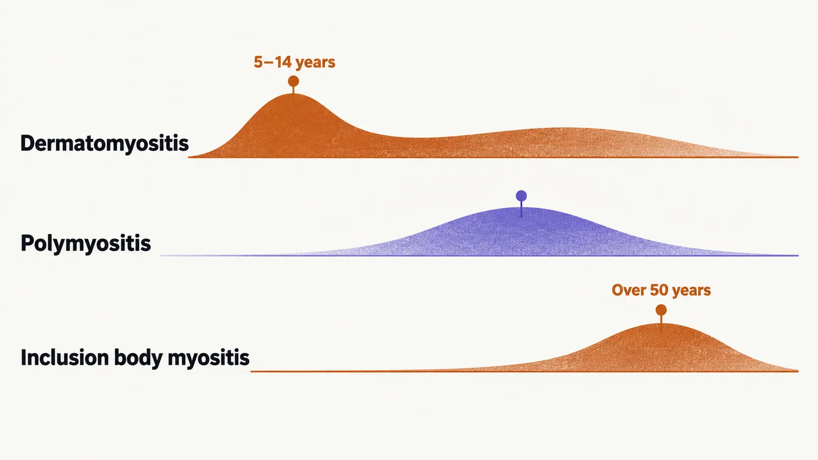 A horizontal age axis with rows for dermatomyositis peaking at 5 to 14 years, polymyositis at middle adulthood, and inclusion body myositis after 50.