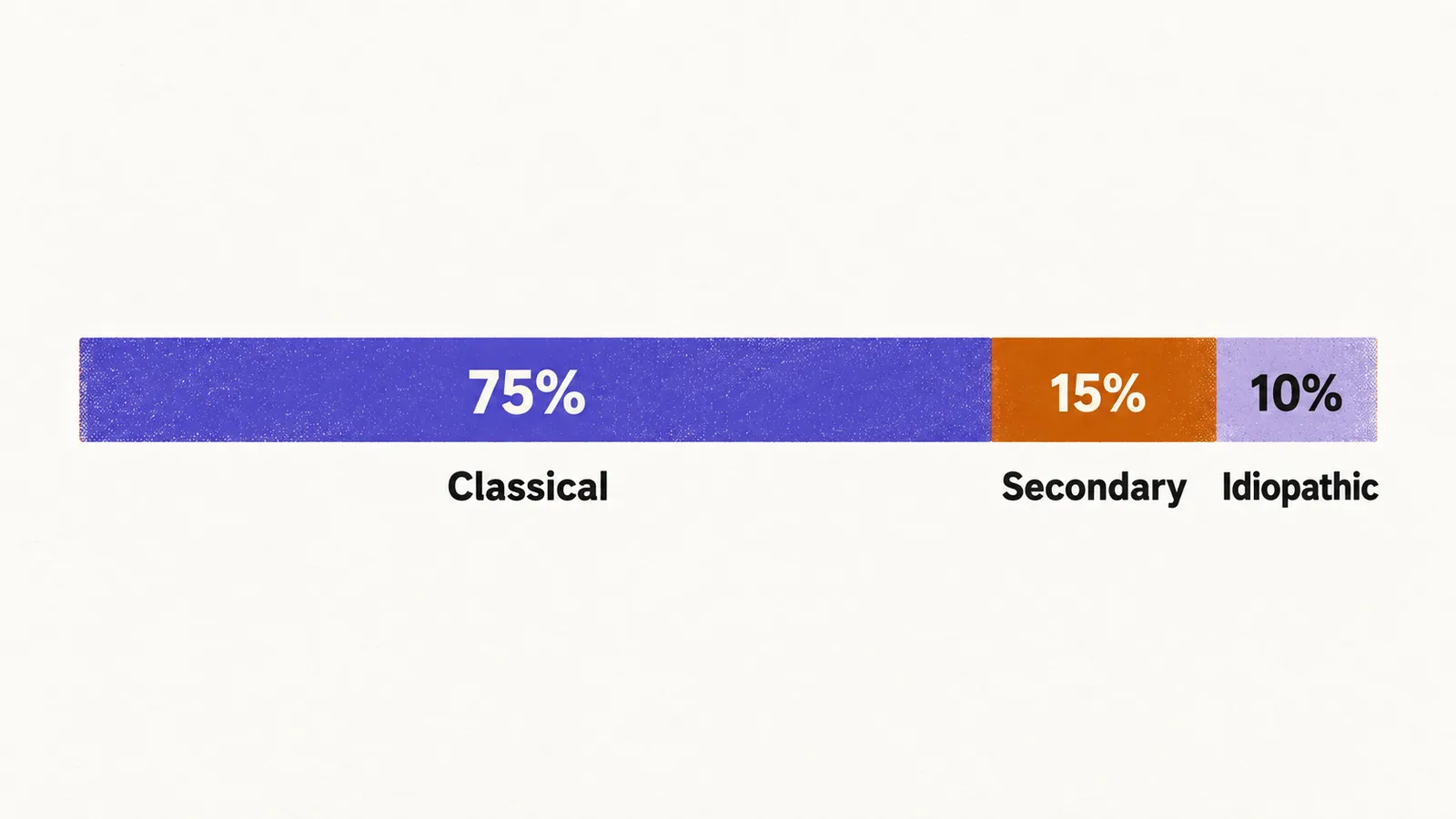 A horizontal bar split into three segments showing causes of trigeminal neuralgia, classical at 75 percent, secondary at 15 percent, and idiopathic at 10 percent.