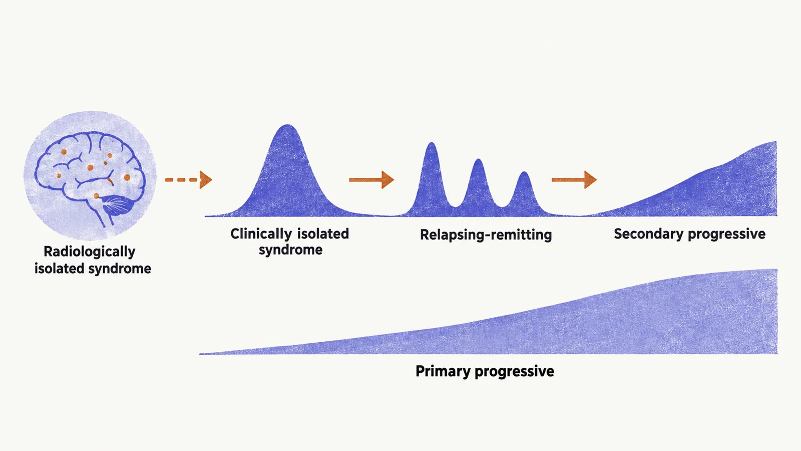 A course diagram shows a first peak becoming relapsing-remitting peaks and then a steady progressive slope, next to a primary progressive slope and a radiologically isolated scan.