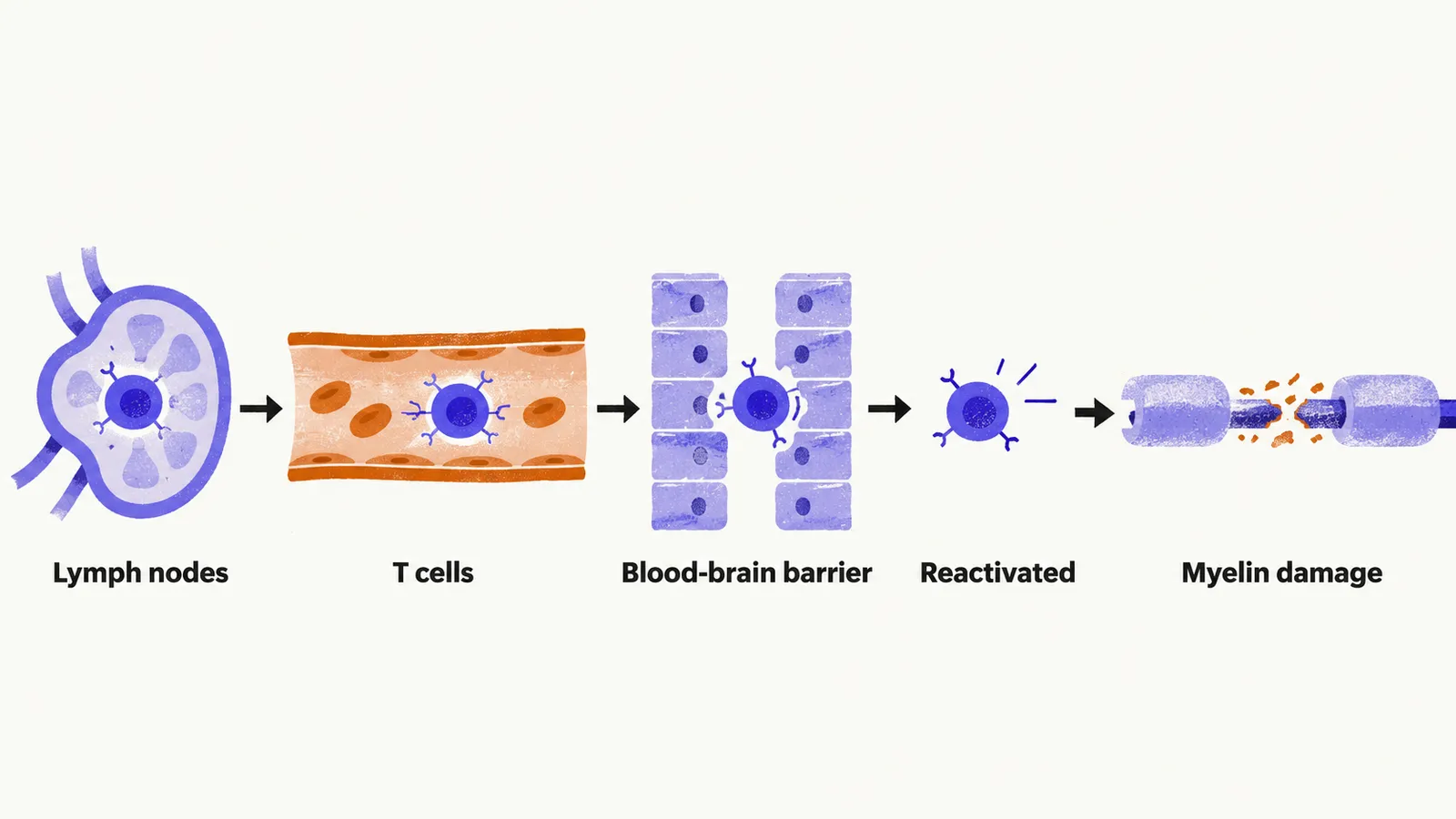 T cells leave a lymph node, travel in blood, cross the blood-brain barrier, are reactivated, and damage myelin on an axon.