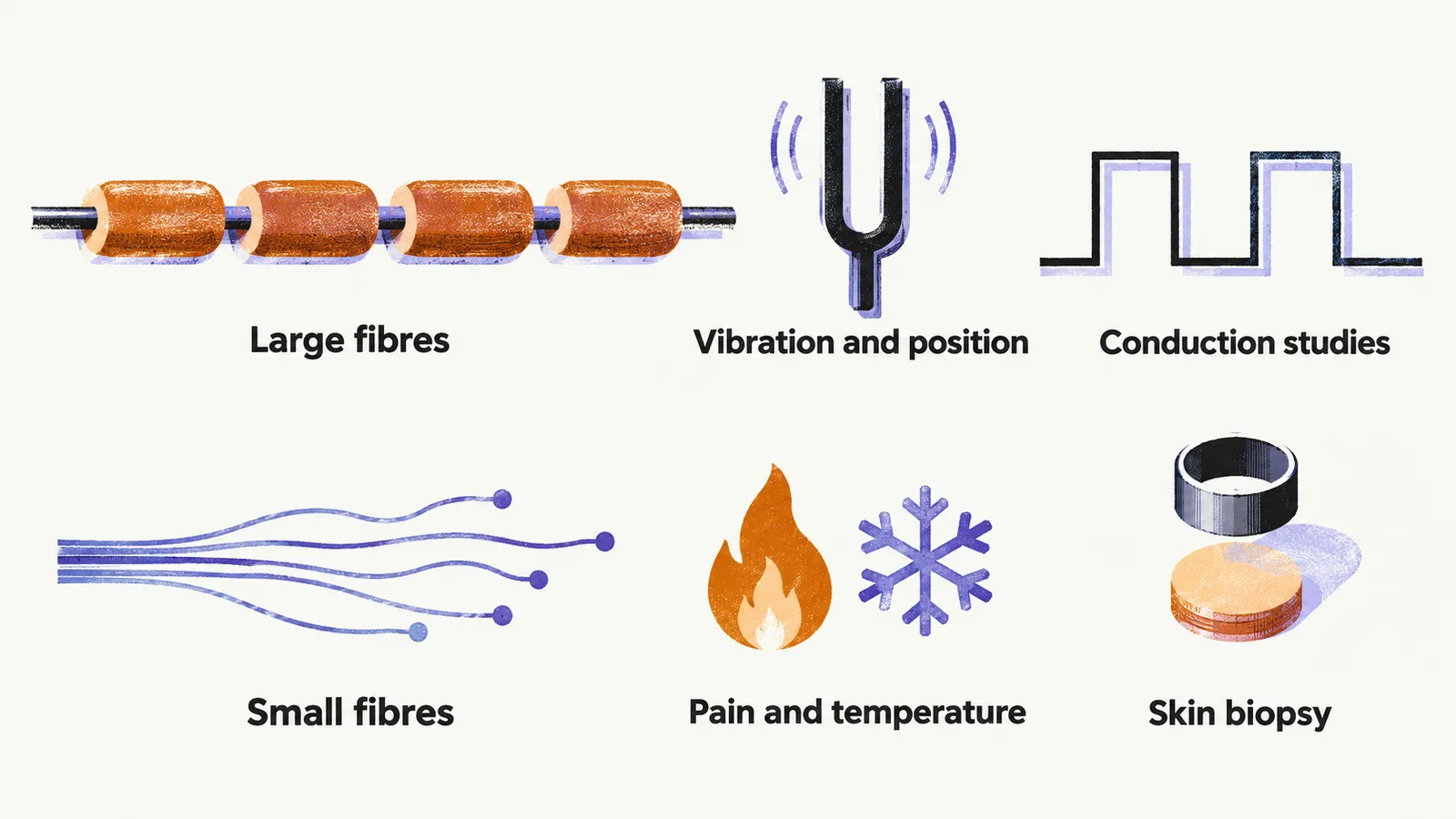 Two rows comparing fibres: thick myelinated fibres tested by conduction studies for vibration and position, and fine bare threads tested by skin biopsy for pain and temperature.