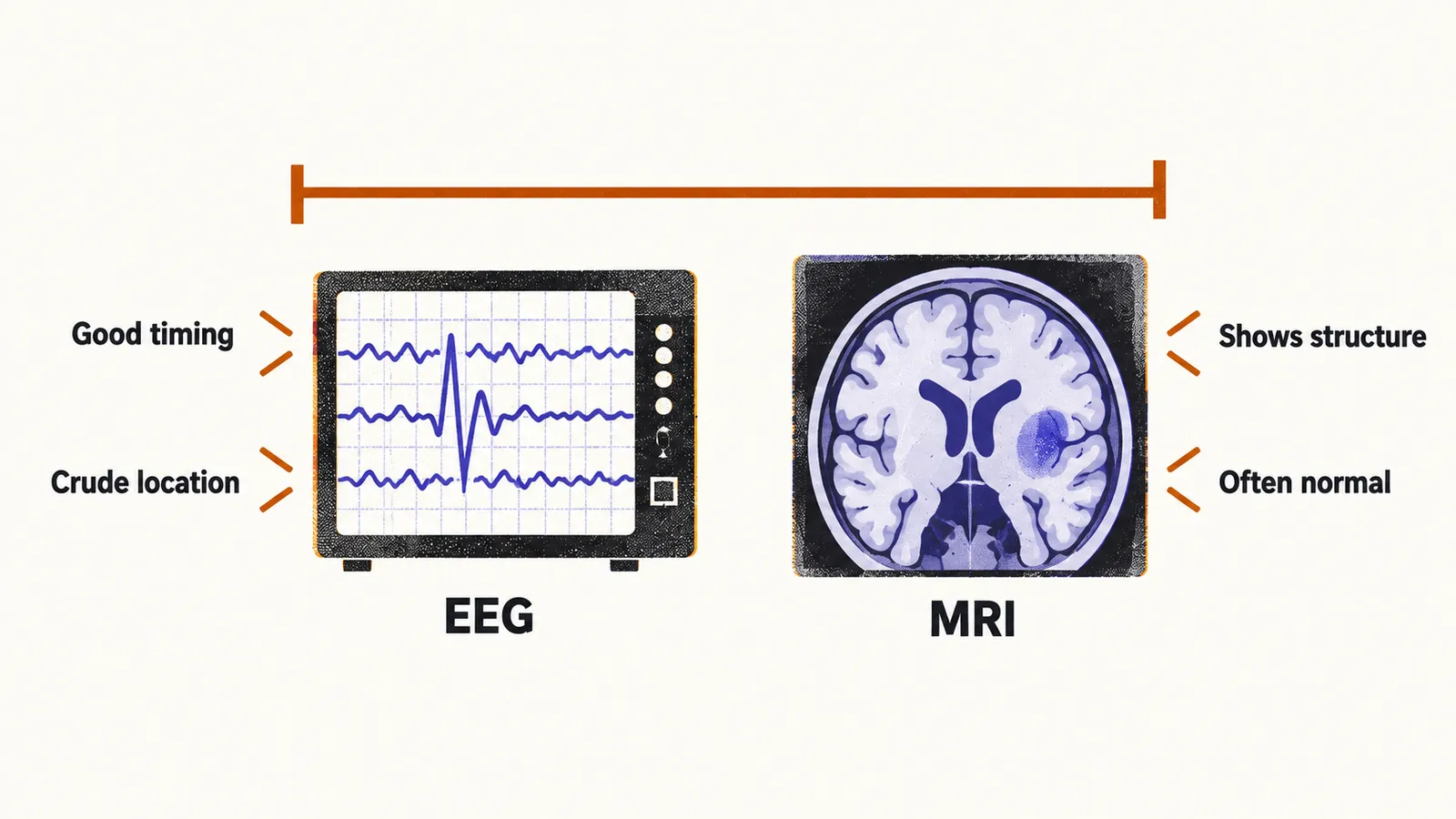 Two panels compare EEG, a waveform with good timing but crude location, and MRI, a brain slice showing structure yet often normal, leaving a gap.