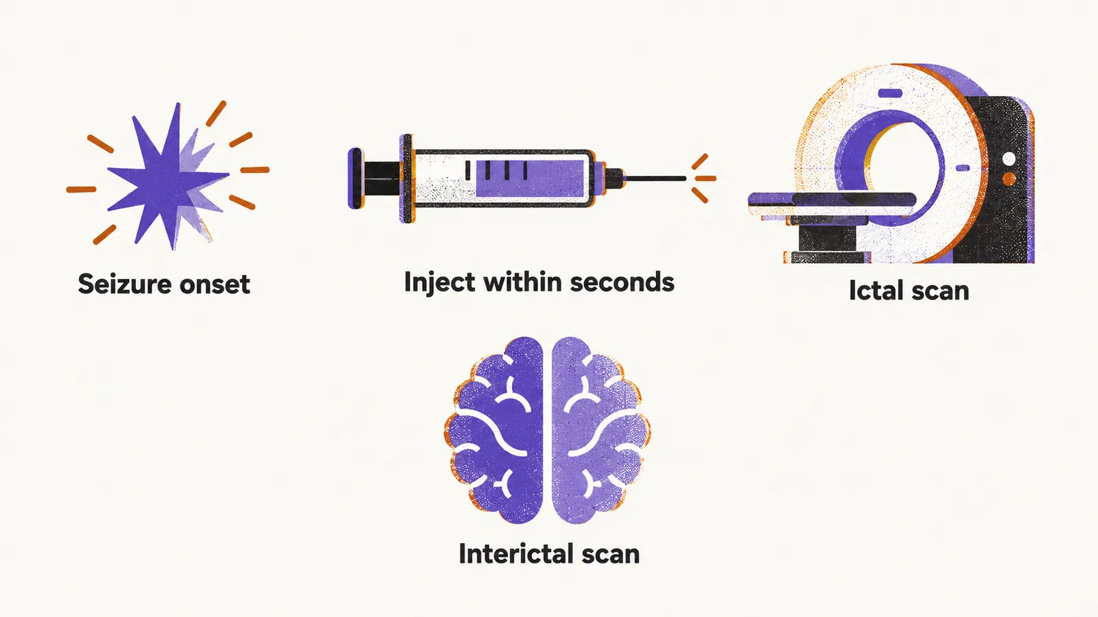 A timeline shows a syringe injecting within seconds of seizure onset for the ictal scan, with a separate interictal scan on a seizure-free day.