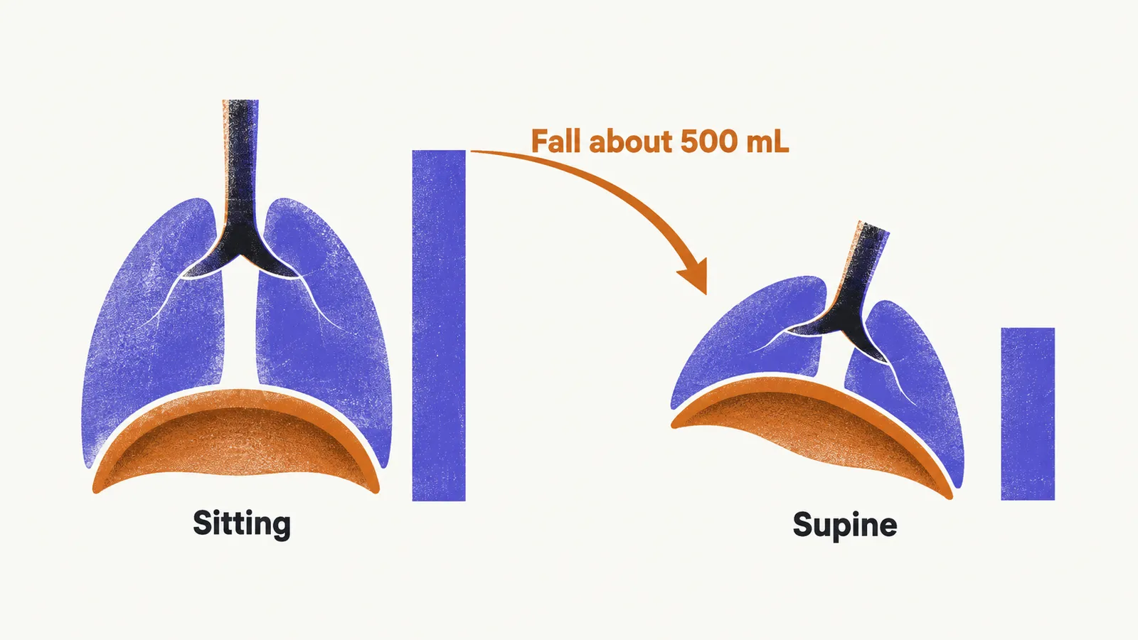 Two lung shapes side by side with trachea, main bronchi and diaphragm, the right one tilted, each with a volume bar, and a saffron fall arrow between them.