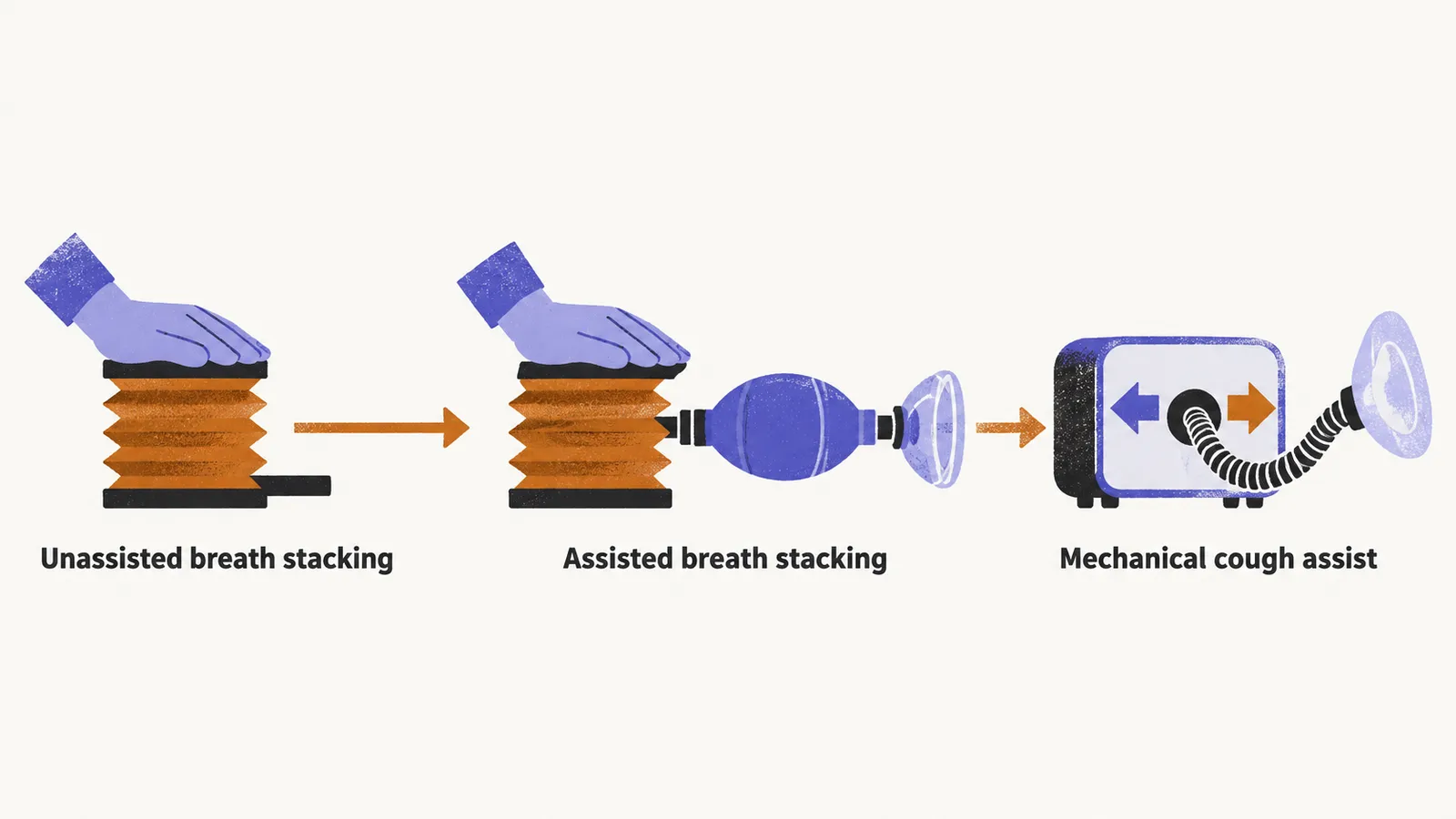 Three stations joined by a saffron arrow: a hand pressing a bellows, the same bellows with a bag attached, and a small machine box with a mask.