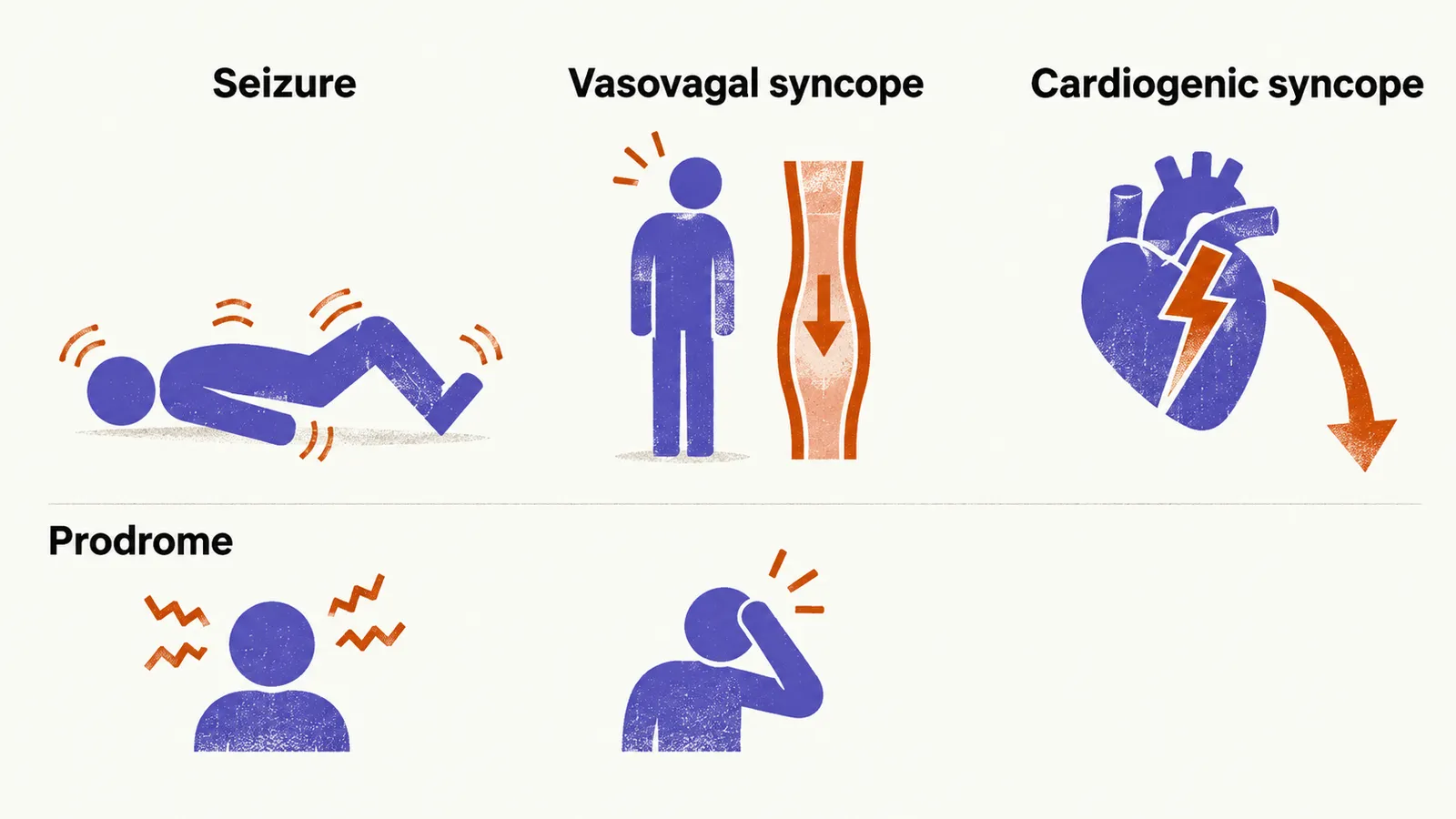 Three columns comparing seizure, vasovagal syncope, and cardiogenic syncope by their onset and prodrome.