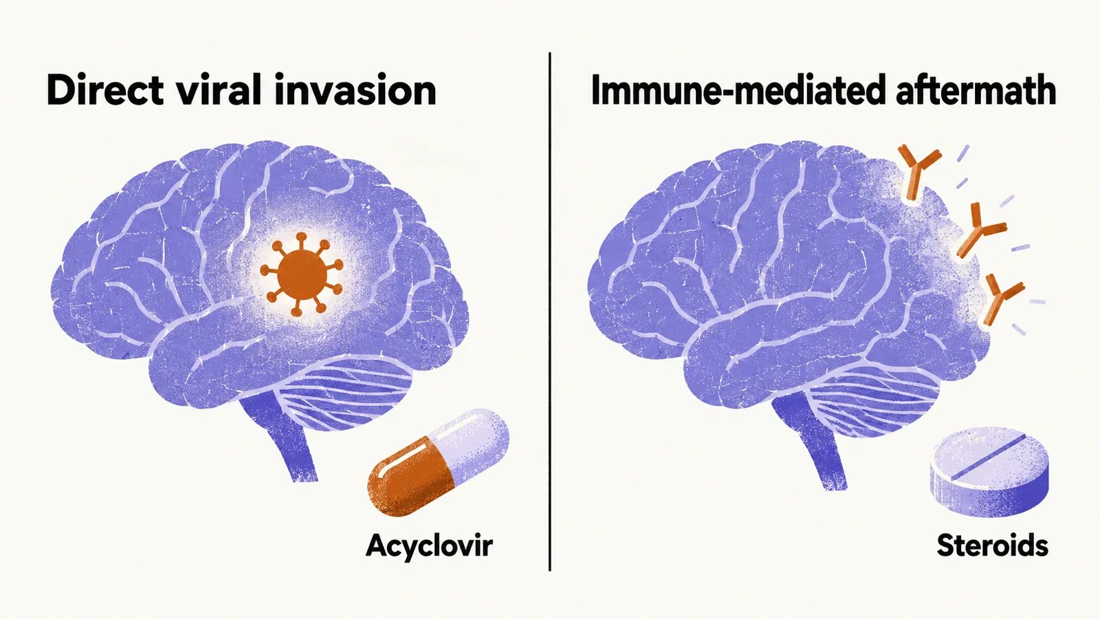 Two panels: a brain with a virus particle beside an acyclovir capsule, and a brain with antibody marks beside a steroid tablet.