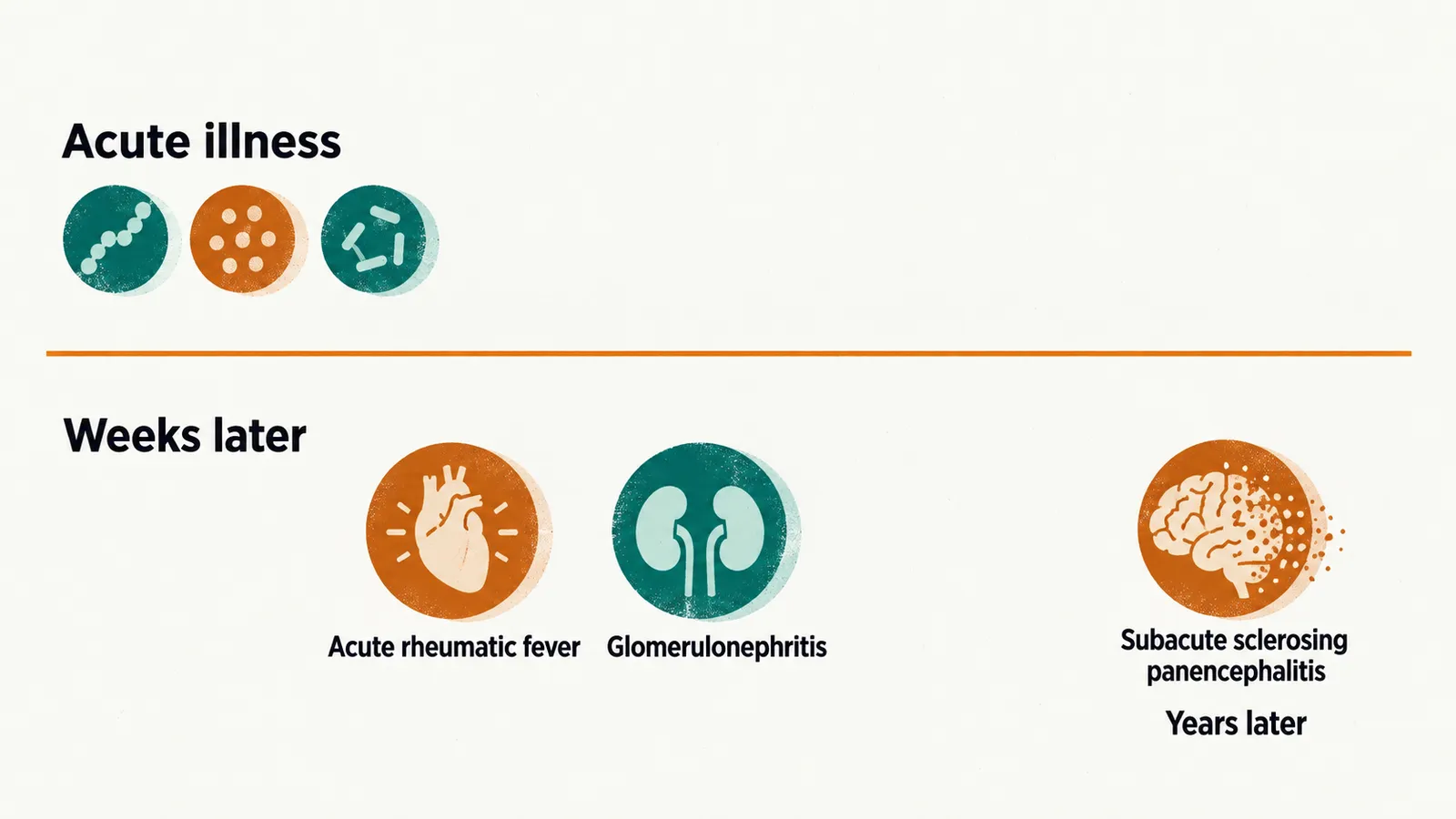Two lanes of discs: Acute illness, three discs; Weeks later, two discs, Acute rheumatic fever and Glomerulonephritis, then far right Years later, one disc, Subacute sclerosing panencephalitis.