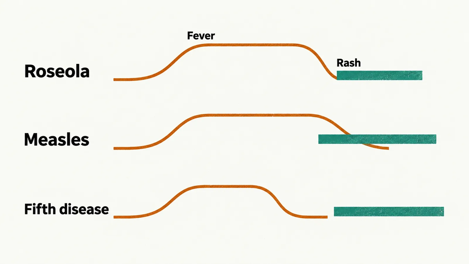 Three stacked timelines on paper. Roseola, the fever curve falls as the rash bar starts. Measles, the rash bar starts while fever is high. Fifth disease, the rash bar comes after the fever.