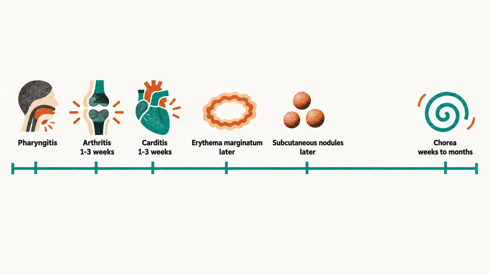 A timeline after pharyngitis with arthritis and carditis at about 1-3 weeks, erythema marginatum and subcutaneous nodules later, and chorea weeks to months.