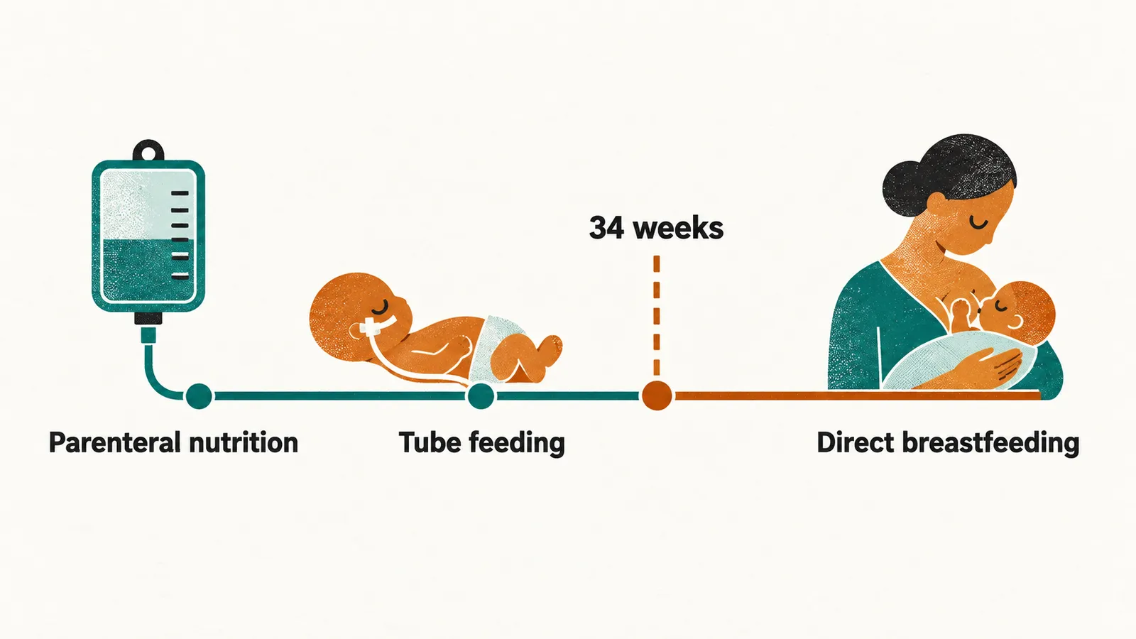 A horizontal line marked 34 weeks, with parenteral nutrition and tube feeding before the mark and direct breastfeeding after it.